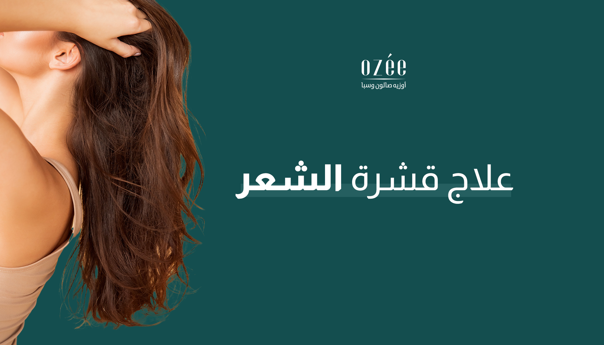 علاج قشرة الشعر: كل ما تحتاجين إلى معرفته